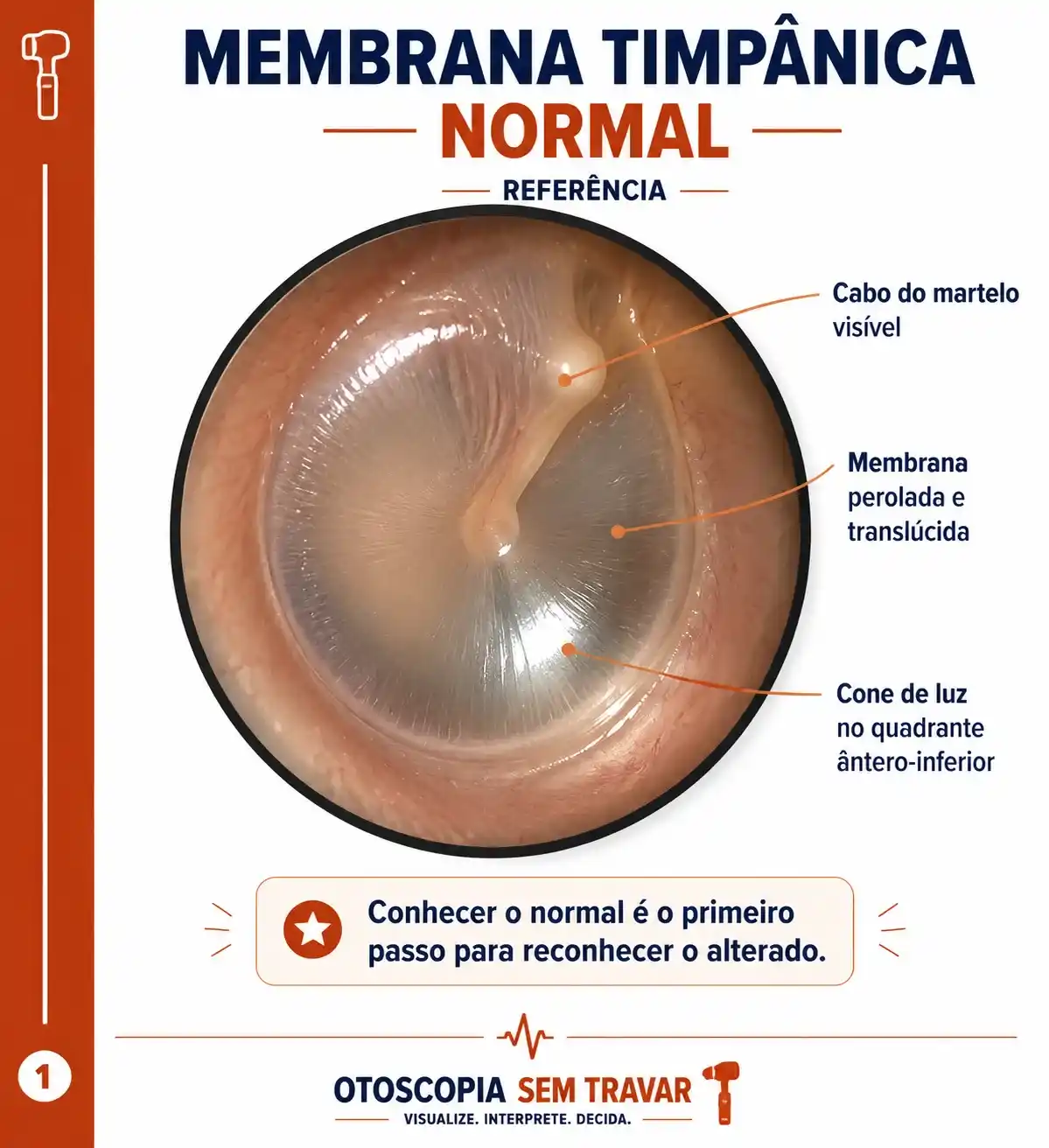 Cor da membrana